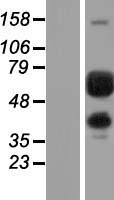 PGM1 Human Over-expression Lysate