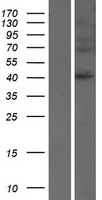 SERPINB8 Human Over-expression Lysate