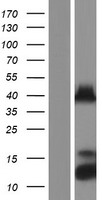 PITX1 Human Over-expression Lysate