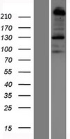Plexin B1 (PLXNB1) Human Over-expression Lysate