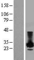 PLP2 Human Over-expression Lysate