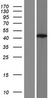 DNA Polymerase beta (POLB) Human Over-expression Lysate