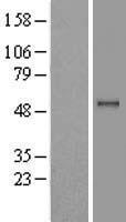 PPM1B Human Over-expression Lysate