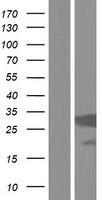 Proteasome 20S alpha 5 (PSMA5) Human Over-expression Lysate