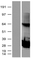 Proteasome subunit beta type 4 (PSMB4) Human Over-expression Lysate