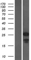 CHMP1A Human Over-expression Lysate