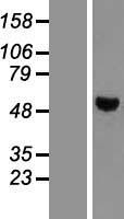 PTP1B (PTPN1) Human Over-expression Lysate