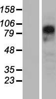 PYGL Human Over-expression Lysate