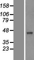 PCYT2 Human Over-expression Lysate