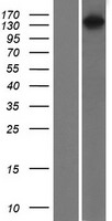 RASGRF1 Human Over-expression Lysate