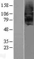 SCTR Human Over-expression Lysate