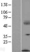 SECTM1 Human Over-expression Lysate