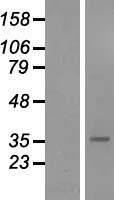 SFRP5 Human Over-expression Lysate