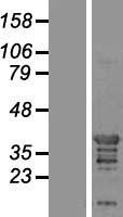 SH3GL2 Human Over-expression Lysate