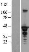 SH3 containing Grb 2 like 1 protein (SH3GL1) Human Over-expression Lysate