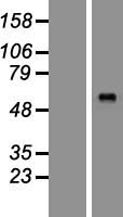 CAT1 (SLC7A1) Human Over-expression Lysate