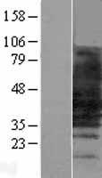 SLC10A1 Human Over-expression Lysate