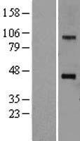 SOAT 1 (SOAT1) Human Over-expression Lysate