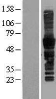CD43 (SPN) Human Over-expression Lysate