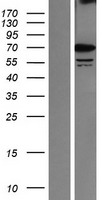 SRPR alpha (SRPRA) Human Over-expression Lysate