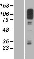 SCP1 (SYCP1) Human Over-expression Lysate