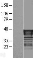 TAL1 Human Over-expression Lysate