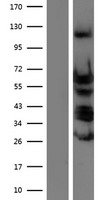 TEAD4 Human Over-expression Lysate