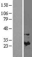 TIMP1 Human Over-expression Lysate