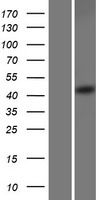 SEC62 Human Over-expression Lysate