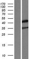 NR2E1 Human Over-expression Lysate