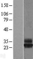 TSPAN4 Human Over-expression Lysate