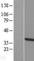 TTC1 Human Over-expression Lysate