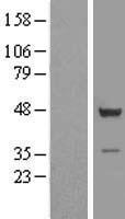 EIPR1 Human Over-expression Lysate