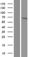 TULP1 Human Over-expression Lysate