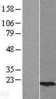 UBE2G2 Human Over-expression Lysate