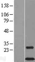 DAP12 (TYROBP) Human Over-expression Lysate
