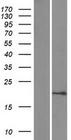 Sumo 1 (SUMO1) Human Over-expression Lysate