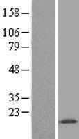 MMS2 (UBE2V2) Human Over-expression Lysate