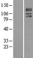USP4 Human Over-expression Lysate