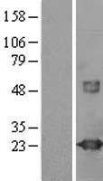 VILIP1 (VSNL1) Human Over-expression Lysate