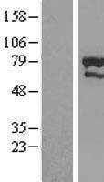 ZNF76 Human Over-expression Lysate