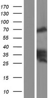 Zyxin (ZYX) Human Over-expression Lysate