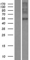 OR1E2 Human Over-expression Lysate