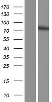 ZNF282 Human Over-expression Lysate