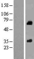 SOAT 2 (SOAT2) Human Over-expression Lysate