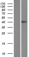 TPST1 Human Over-expression Lysate