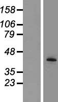 TPST2 Human Over-expression Lysate