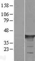 Growth Arrest Specific Protein 7 (GAS7) Human Over-expression Lysate