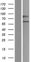 CDC14A Human Over-expression Lysate
