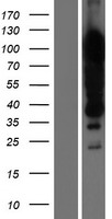 KHSRP Human Over-expression Lysate